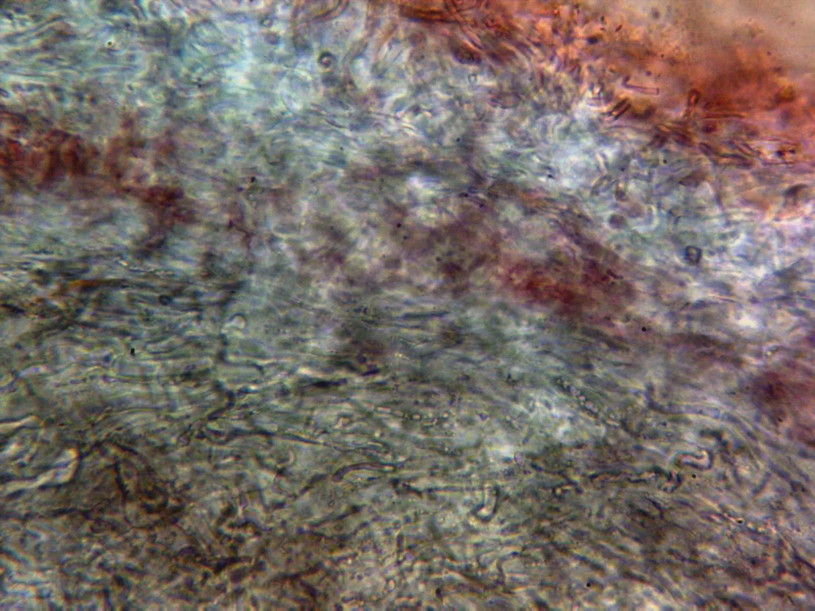 Microscopía de Russula amethystina - 13 - Pileipellis x 400